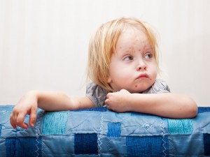 Urticaria la copil (umflături mici şi roşii pe piele însoţite de mâncărime)