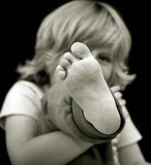 Picioare crăpate la copii